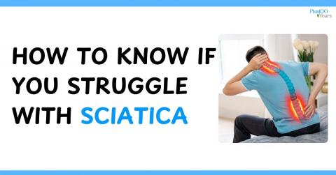 sciatica