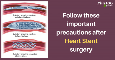  Heart Stent surgery