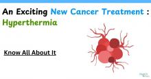 An Exciting New Cancer Treatment  Hyperthermia 