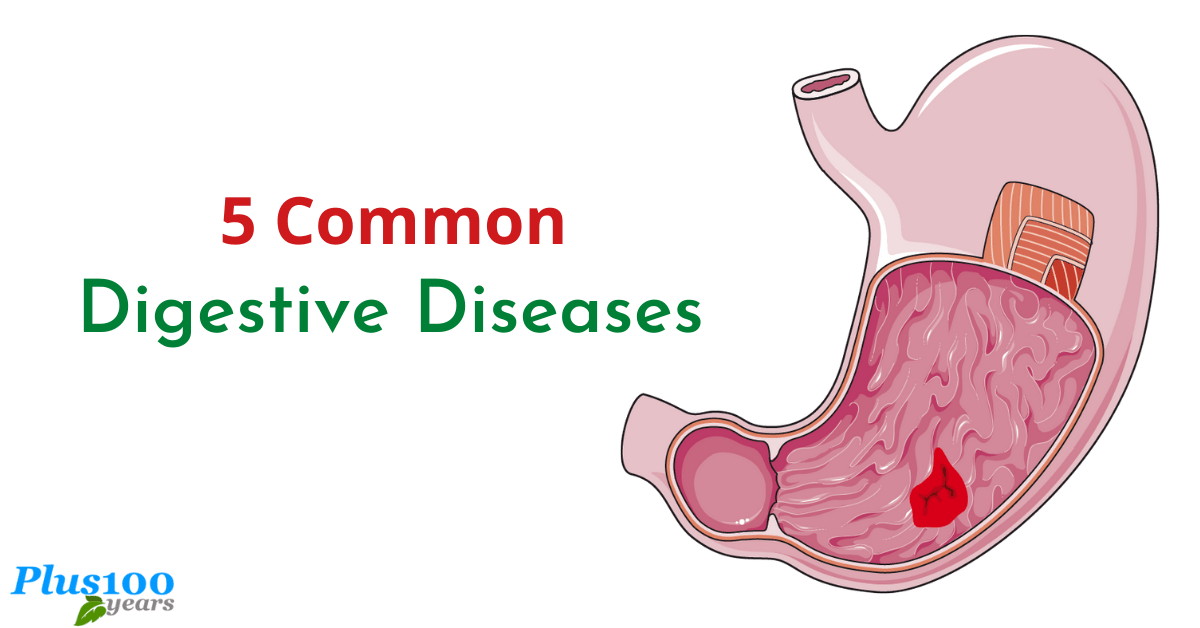 5 Common Digestive Diseases